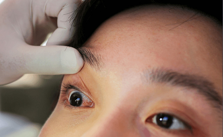 Ocular Emergency Care