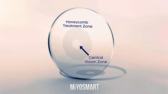 MIYOSMART Lenses by hoya