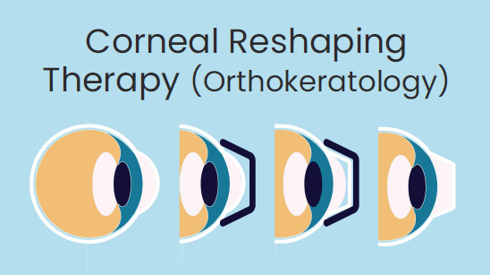 Orthokeratology